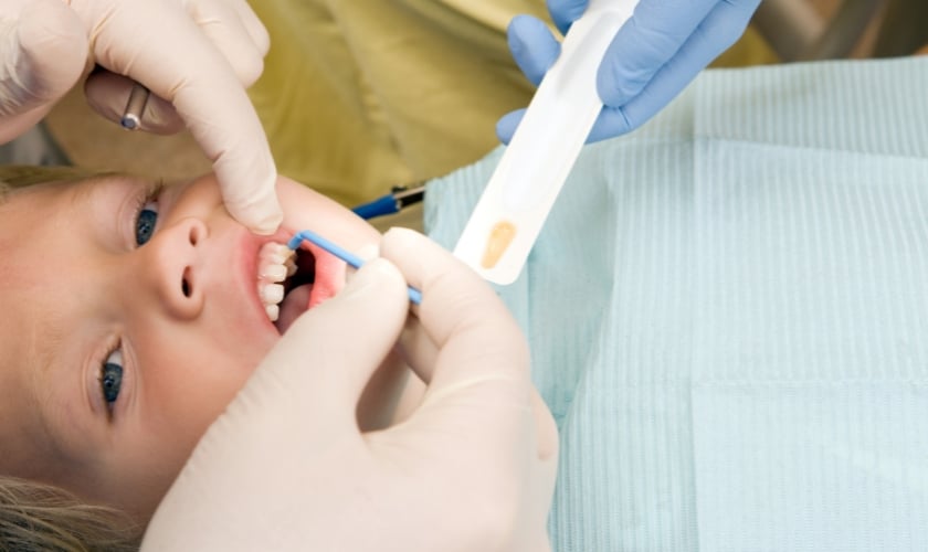 why you shouldnt skip your regular fluoride cleanings