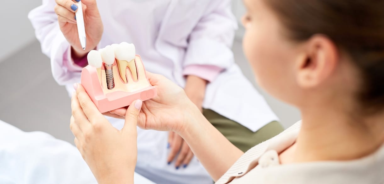 How Long Do Dental Implants Last? Factors That Affect Their Lifespan