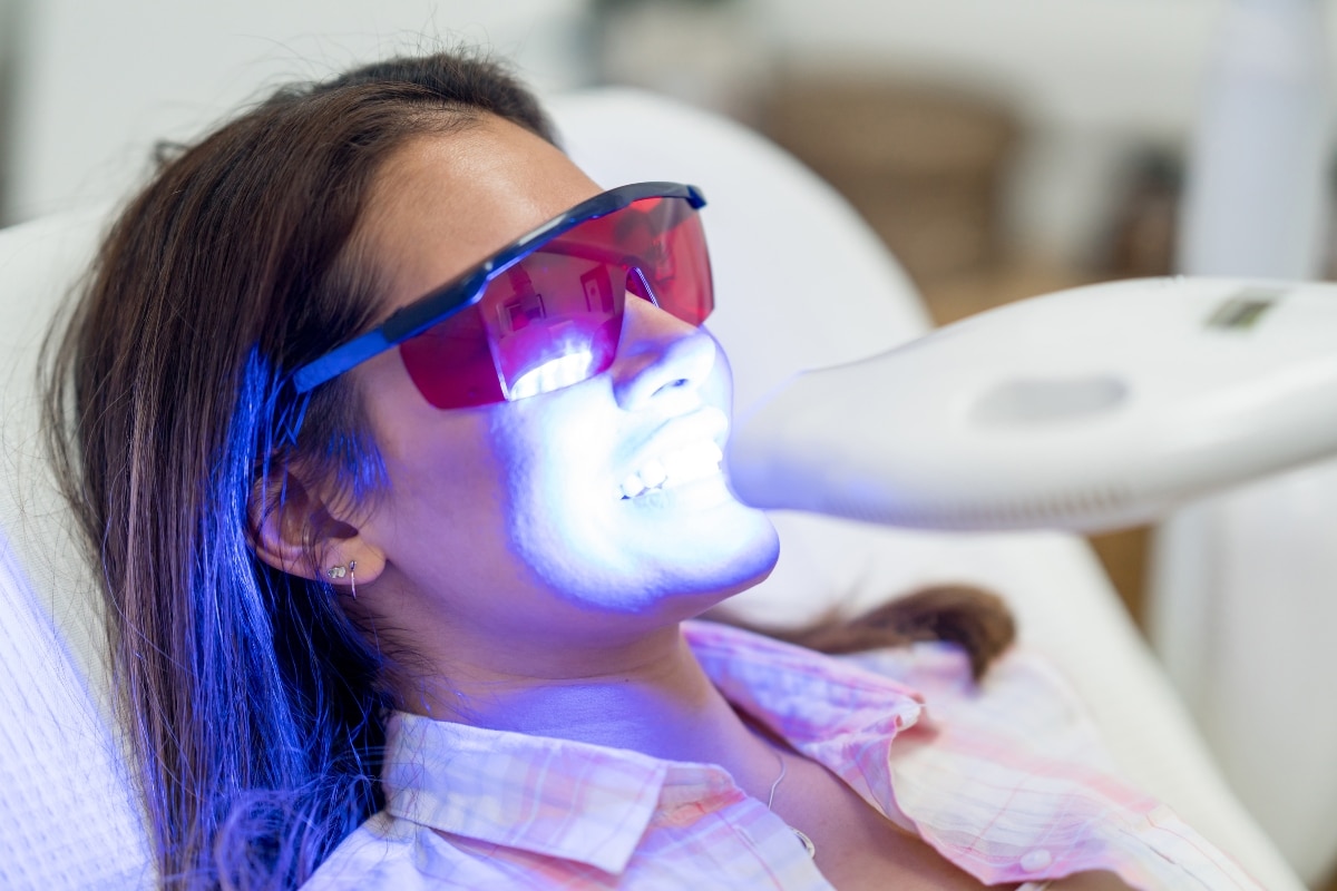 teeth-whitening-in-San-Juan-Capistrano