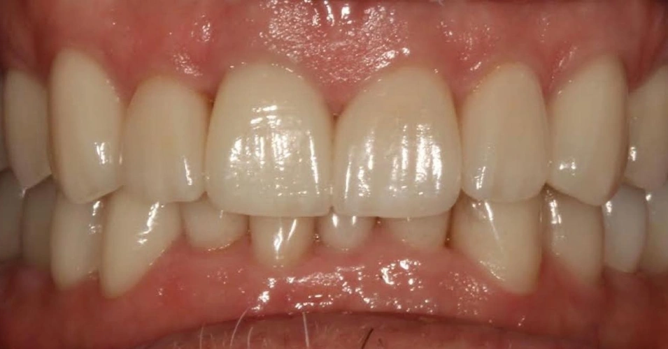 smilegallery after image