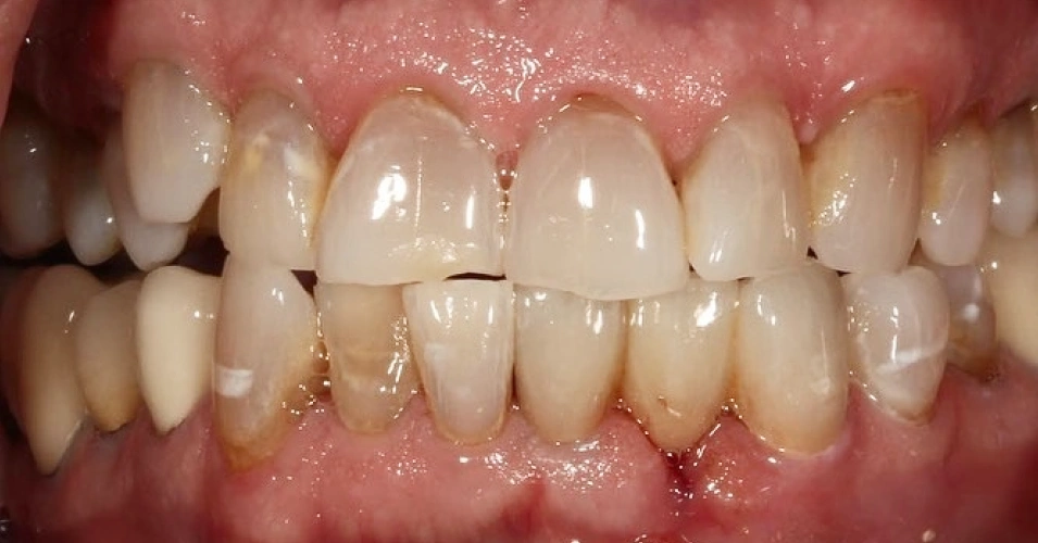 smilegallery after image