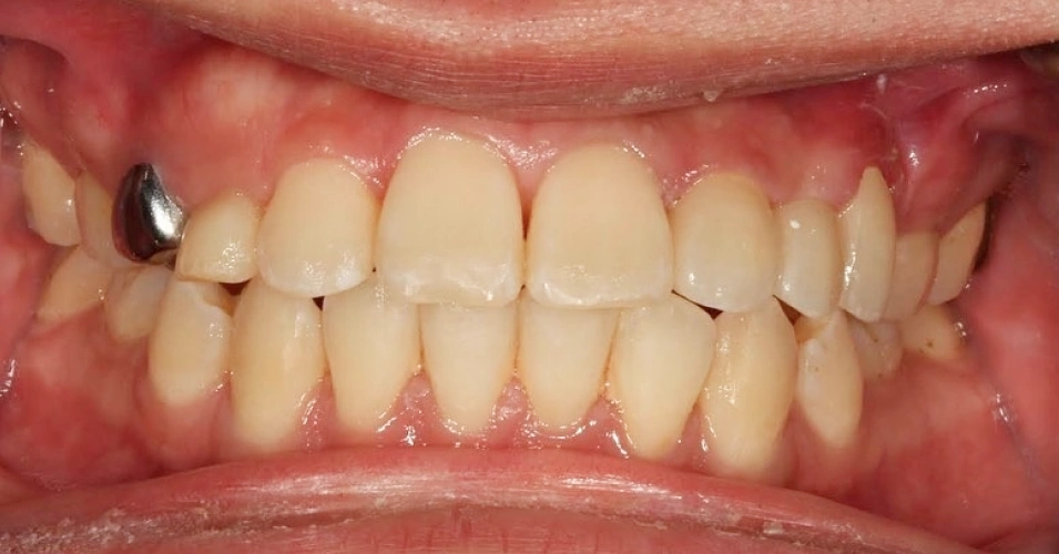 smilegallery after image