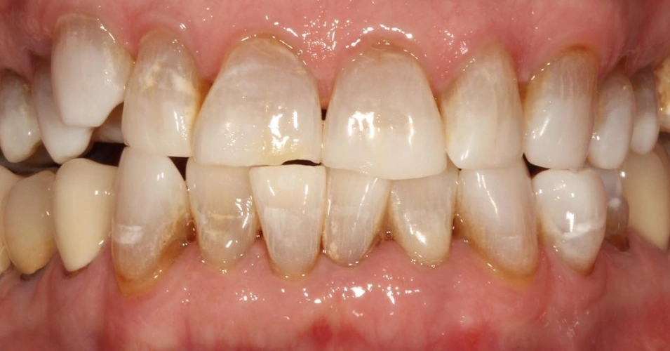 smilegallery after image