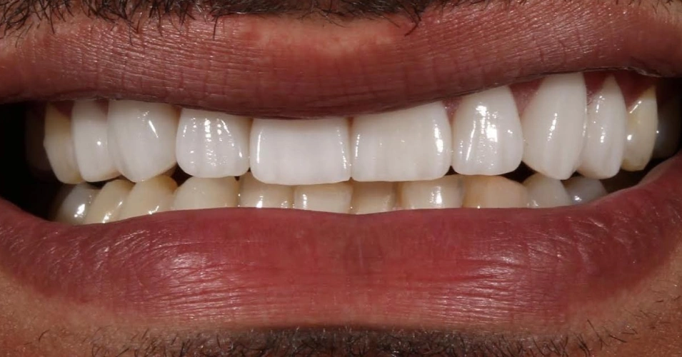 smilegallery after image