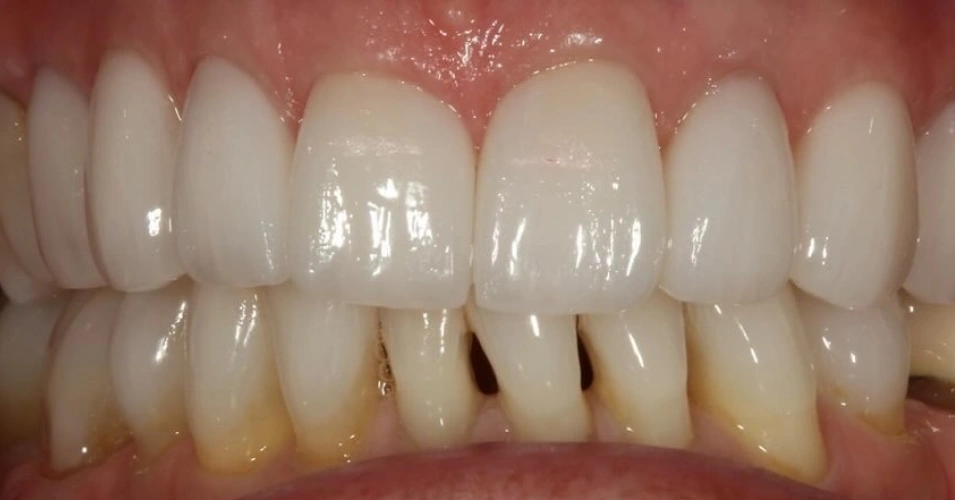 smilegallery after image