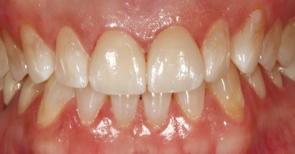 smilegallery Before image