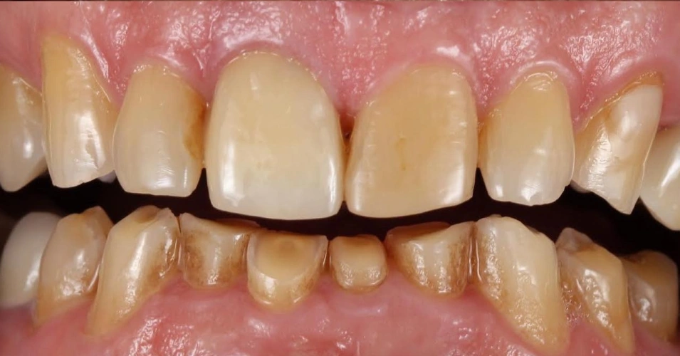 smilegallery Before image