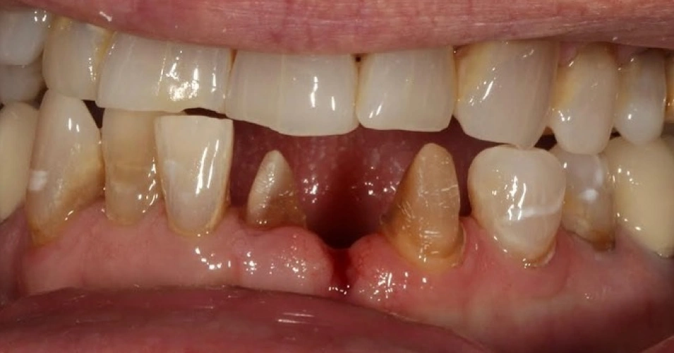 smilegallery Before image