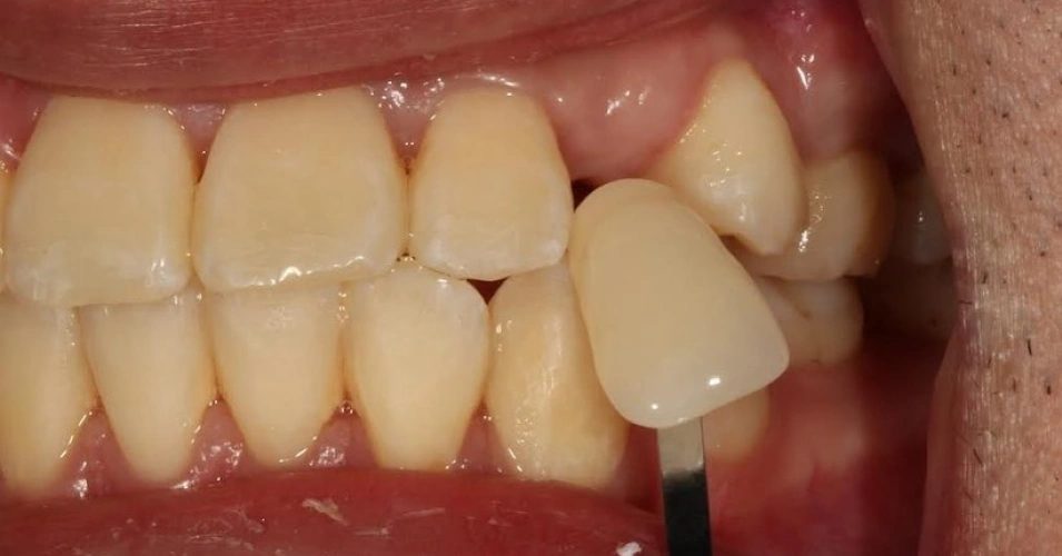 smilegallery Before image