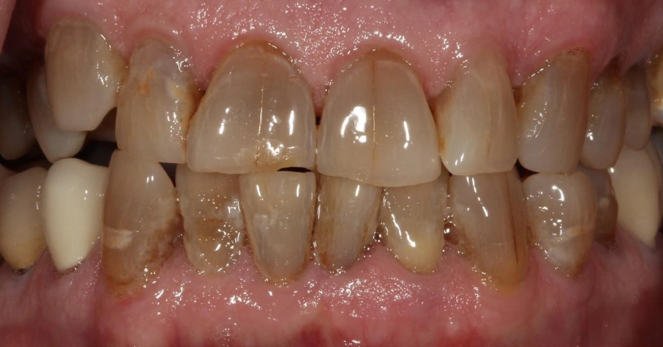 smilegallery Before image