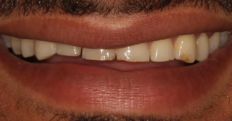 smilegallery Before image