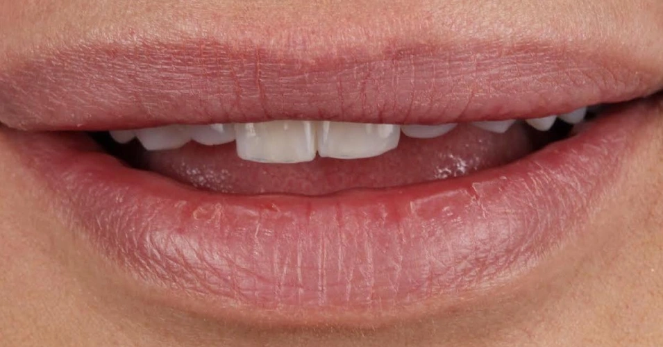 smilegallery Before image