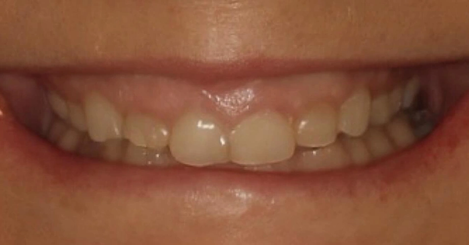 smilegallery Before image