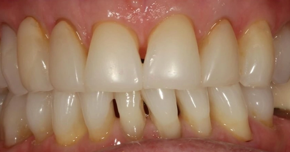 smilegallery Before image