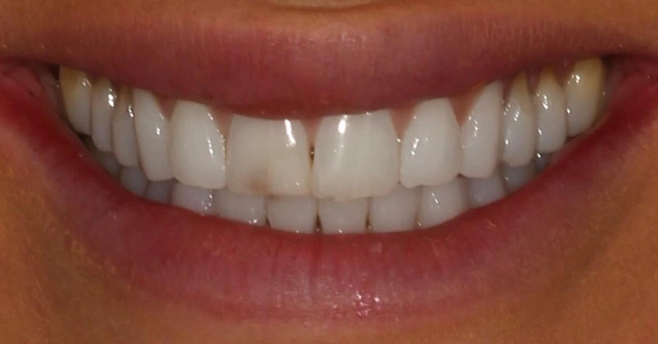 smilegallery Before image