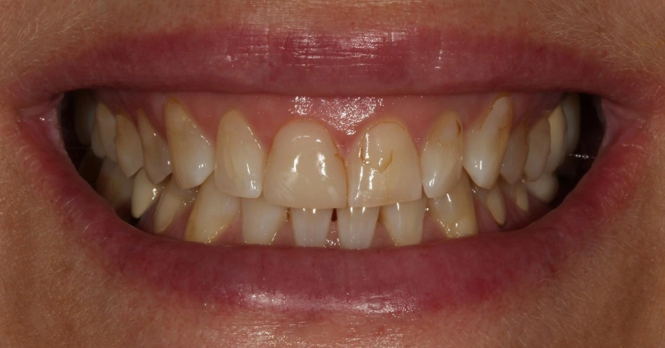 smilegallery after image