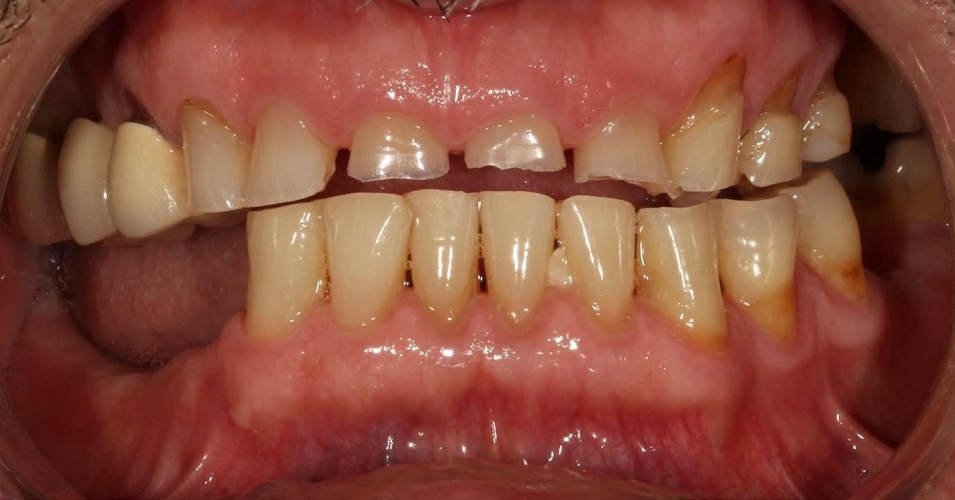 smilegallery Before image