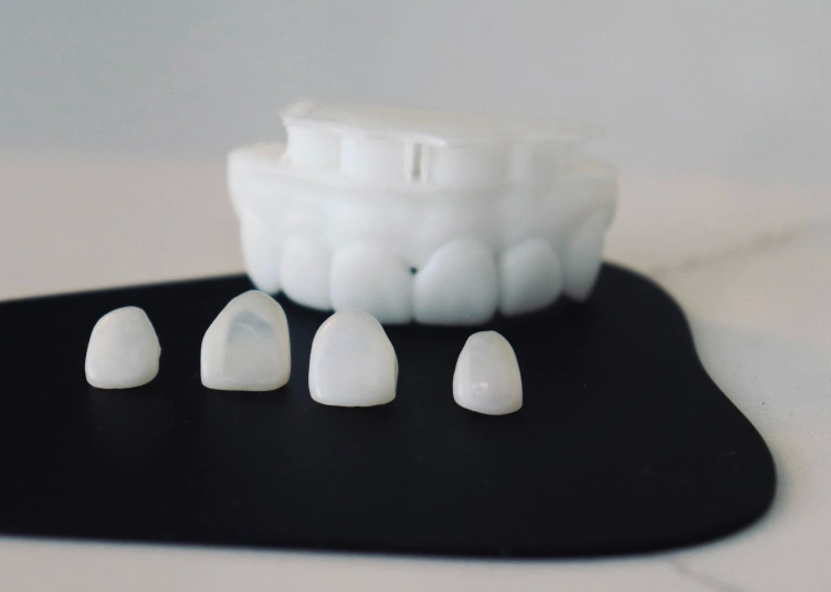 veneers-process-image