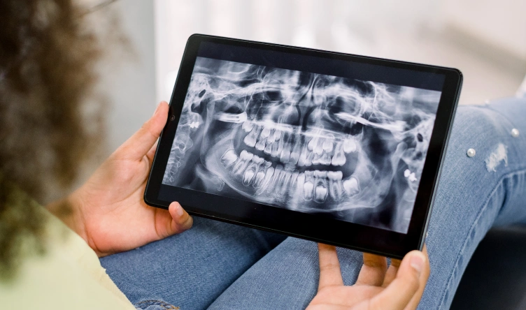 tooth-extraction-process-image